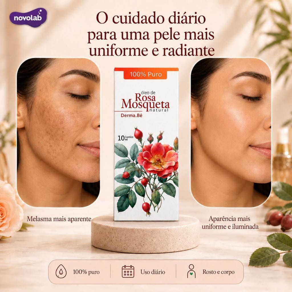  ÓLEO VEGETAL DE ROSA MOSQUETA 30ML - 100% Puro - Hidratante - Clareador
